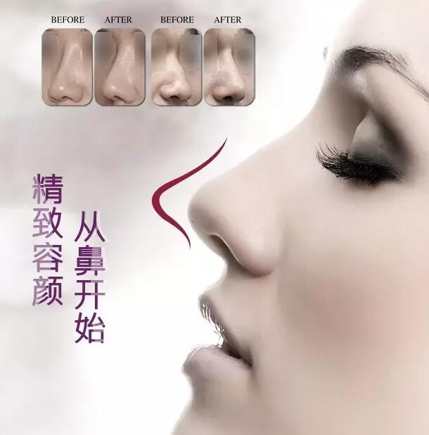 精致容顏，從鼻開始