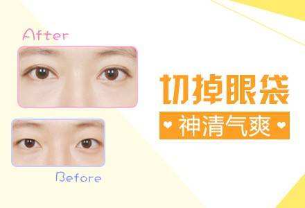 祛眼袋.jpg