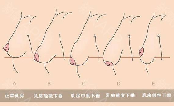 乳房.jpg