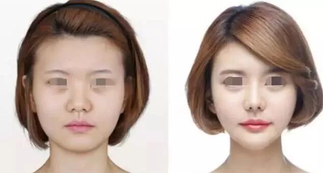 情人節(jié)活動(dòng)-海南整形3