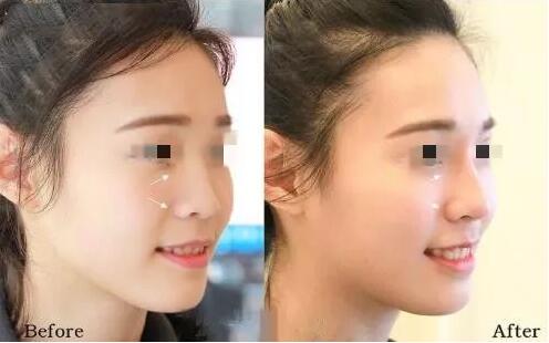 情人節(jié)活動(dòng)-海南整形4